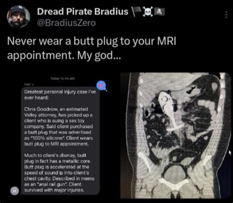 butt plug mri|mri to ct.